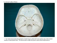 1A. Internal Auditory Meatus