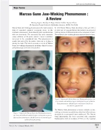 Marcus Gunn Jaw-Winking Phenomenon : a Review Dewang Angmo, Mandeep S