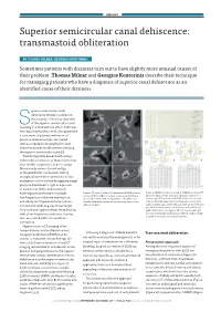 Superior Semicircular Canal Dehiscence: Transmastoid Obliteration