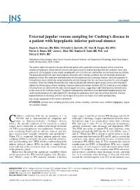 External Jugular Venous Sampling for Cushing's Disease in a Patient With