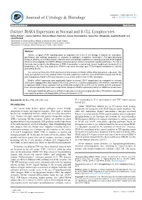 Distinct IRAK4 Expression in Normal and B-CLL Lymphocytes