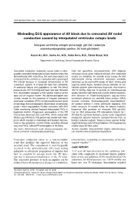 Misleading ECG Appearance of AV Block Due to Concealed AV Nodal Conduction Caused by Interpolated Ventricular Ectopic Beats