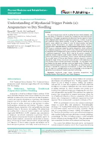 Understanding of Myofascial Trigger Points (2): Acupuncture Vs Dry Needling