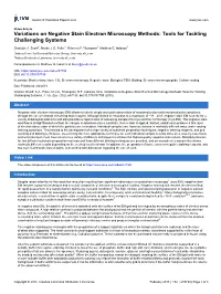 Variations on Negative Stain Electron Microscopy Methods: Tools for Tackling Challenging Systems