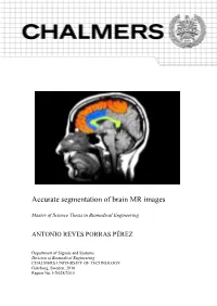 Accurate Segmentation of Brain MR Images
