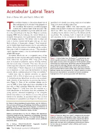 Acetabular Labral Tears
