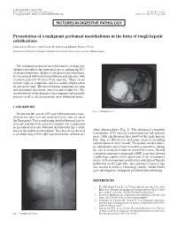 Presentation of a Malignant Peritoneal Mesothelioma in the Form of Rough