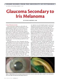 Glaucoma Secondary to Iris Melanoma