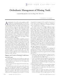 Orthodontic Management of Missing Teeth