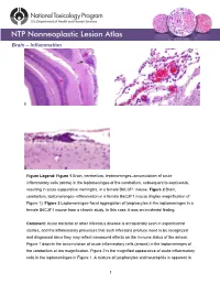Brain – Inflammation