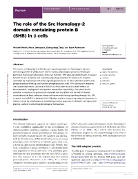 The Role of the Src Homology-2 Domain Containing Protein B (SHB) in B Cells