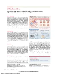 Artificial Heart Valves