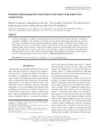 Formation of Ghost Images Due to Metal Objects on the Surface of the Patient’S Face: a Pictorial Essay