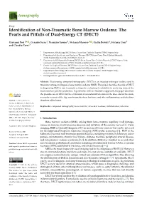 Identification of Non-Traumatic Bone Marrow Oedema