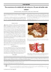 A Rare Presentation of Duplicated Inferior Vena Cava in a Donor