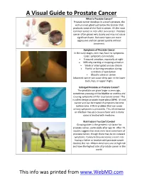 A Visual Guide to Prostate Cancer
