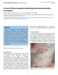 A Case of Tinea Incognito Mimicking Subcorneal Pustular Dermatosis Göknur Kalkan1, D Deniz Demirseren2, Cansu Altınöz Güney1, Akın Aktaş1