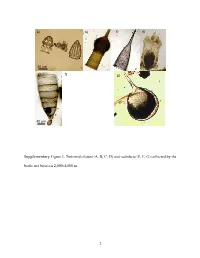 Supplementary Figure 1. Tintinnid Ciliates (A, B, C, D) and Radiolaria (E, F, G) Collected by the Bottle Net Between 2,000-4,000 M