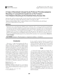 A Case of Abciximab Induced Acute Profound Thrombocytopenia Resulting in Compartment Syndrome of the Forearm from Massive Bleeding at the Brachial Artery Access Site