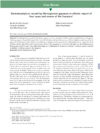 Dermatophytosis Caused by Microsporum Gypseum in Infants: Report of Four Cases and Review of the Literature*