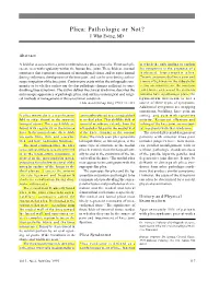 Plica: Pathologic Or Not? J