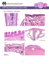 Nose, Epithelium – Hyperplasia