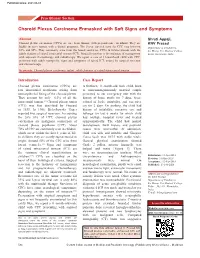 Choroid Plexus Carcinoma Enmasked with Soft Signs and Symptoms