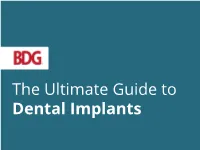 The Ultimate Guide to Dental Implants Introduction
