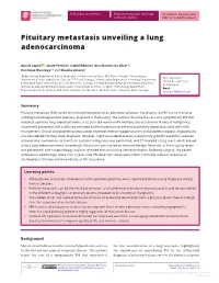 Pituitary Metastasis Unveiling a Lung Adenocarcinoma