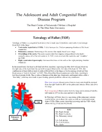 Tetralogy of Fallot (TOF)