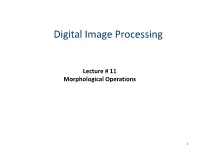 Digital Image Processing