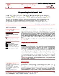 Masquerading Bundle Branch Block