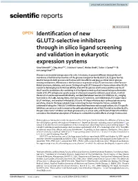 Identification of New GLUT2-Selective Inhibitors Through in Silico Ligand