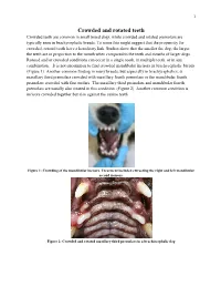 Crowded and Rotated Teeth Crowded Teeth Are Common in Small Breed Dogs, While Crowded and Rotated Premolars Are Typically Seen in Brachycephalic Breeds