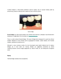A Dental Bridge Is a Fixed Dental Prosthesis Used to Replace One Or Several Missing Teeth by Permanently Joining an Artificial T