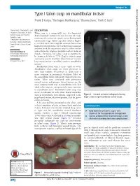 Type I Talon Cusp on Mandibular Incisor Pratik B Kariya,1 Rachappa Mallikarjuna,2 Bhavna Dave,1 Parth B Joshi1