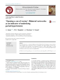 Bilateral Varicoceles As an Indicator of Underlying Portal-Hypertension