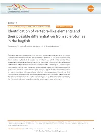 Identification of Vertebra-Like Elements and Their Possible Differentiation from Sclerotomes in the Hagfish