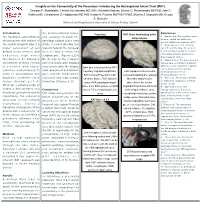 Insights on the Connectivity of the Precuneus: Introducing the Retrosplenial Aslant Tract (RAT)