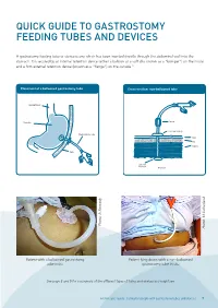 Quick Guide to Gastrostomy Feeding Tubes and Devices