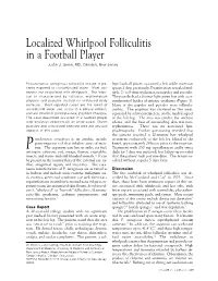 Localized Whirlpool Folliculitis in a Football Player Justin J
