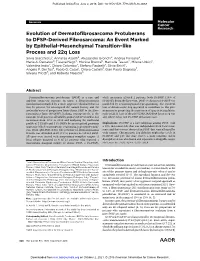 Evolution of Dermatofibrosarcoma Protuberans to DFSP-Derived Fibrosarcoma: an Event Marked by Epithelial−Mesenchymal Transition−Like Process and 22Q Loss