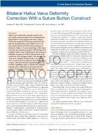 Bilateral Hallux Varus Deformity Correction with a Suture Button Construct