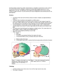 Craniosynostosis (Sometimes Called Craniostenosis) Is a Disorder in Which There Is Early Fusion of the Sutures of the Skull in Childhood
