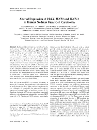 Altered Expression of PRKX, WNT3 and WNT16 in Human Nodular
