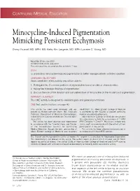 Minocycline-Induced Pigmentation Mimicking Persistent Ecchymosis