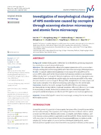 Investigation of Morphological Changes of HPS Membrane Caused by Cecropin B Through Scanning Electron Microscopy and Atomic Forc