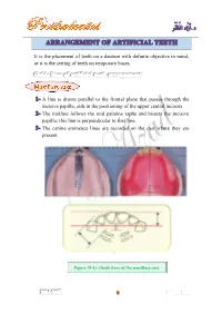 It Is the Placement of Teeth on a Denture with Definite Objective in Mind, Or It Is the Setting of Teeth on Temporary Bases