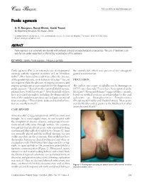 Case Report Full Text Online At