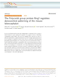 The Polycomb Group Protein Ring1 Regulates Dorsoventral Patterning Of